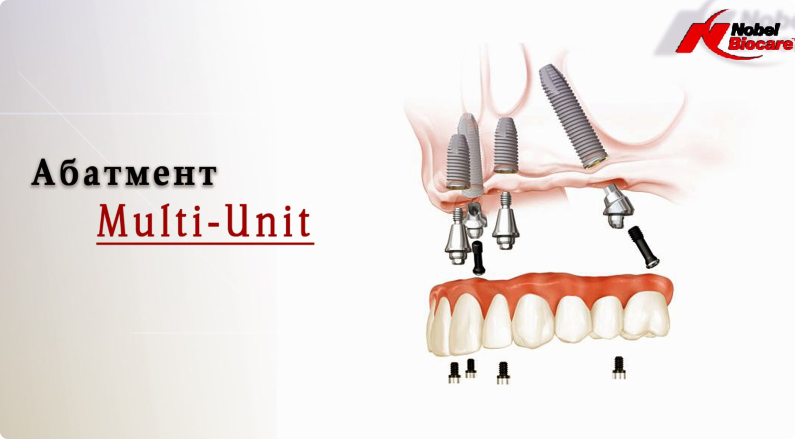 Абатмент Multi-unit