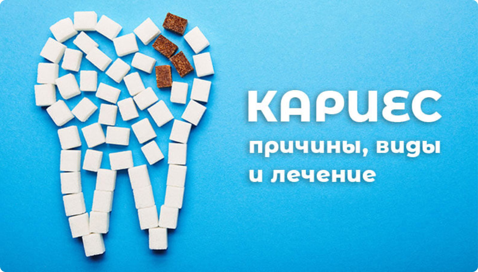 Кариес — причины заболевания, виды кариеса, диагностика и лечение