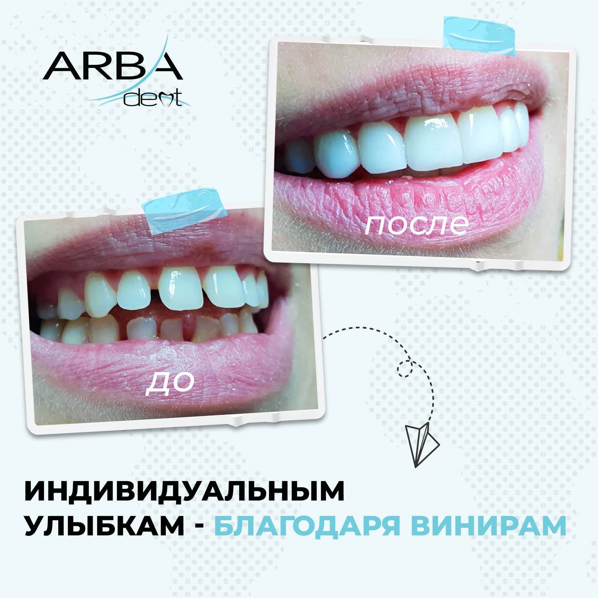 Результат лечения