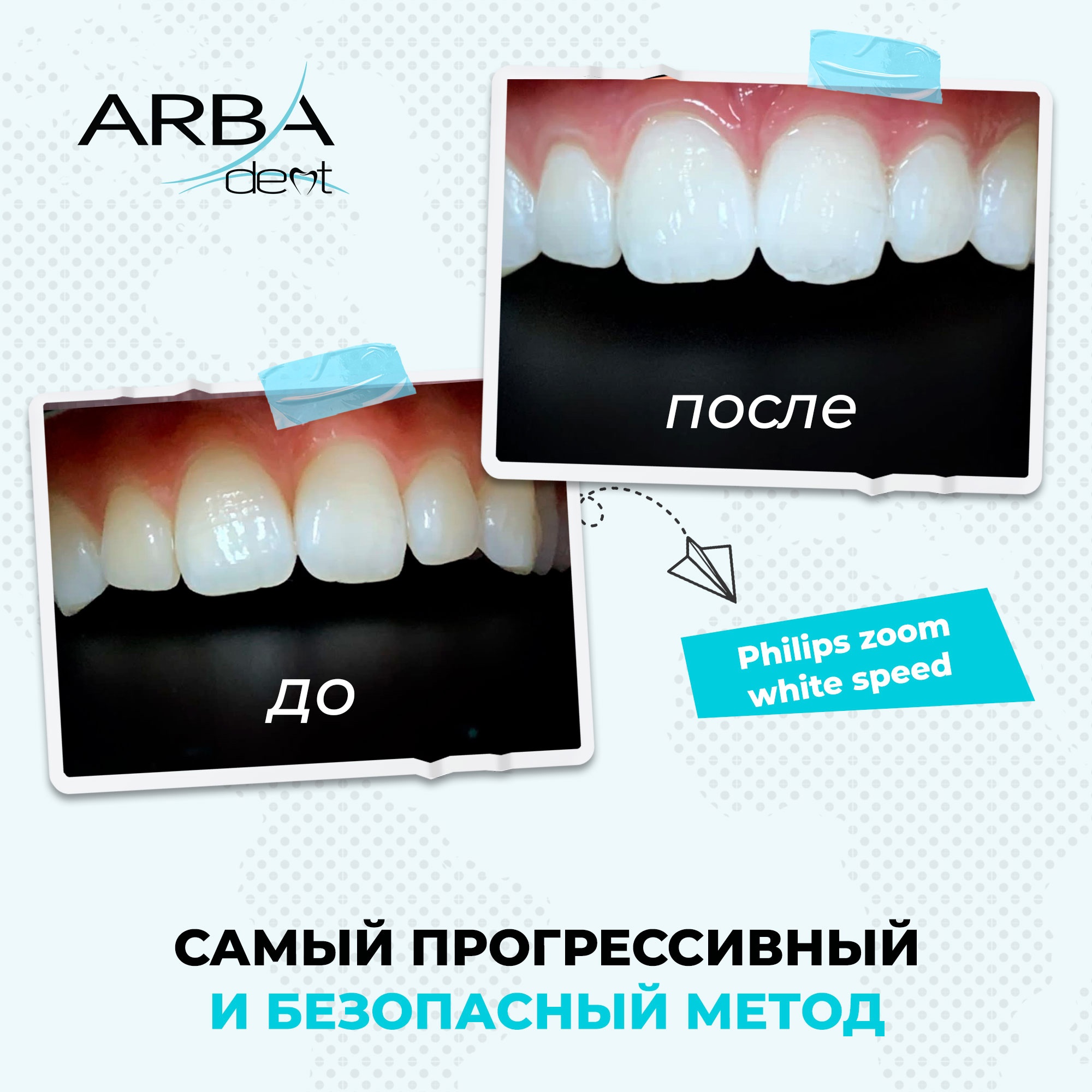 Результат лечения