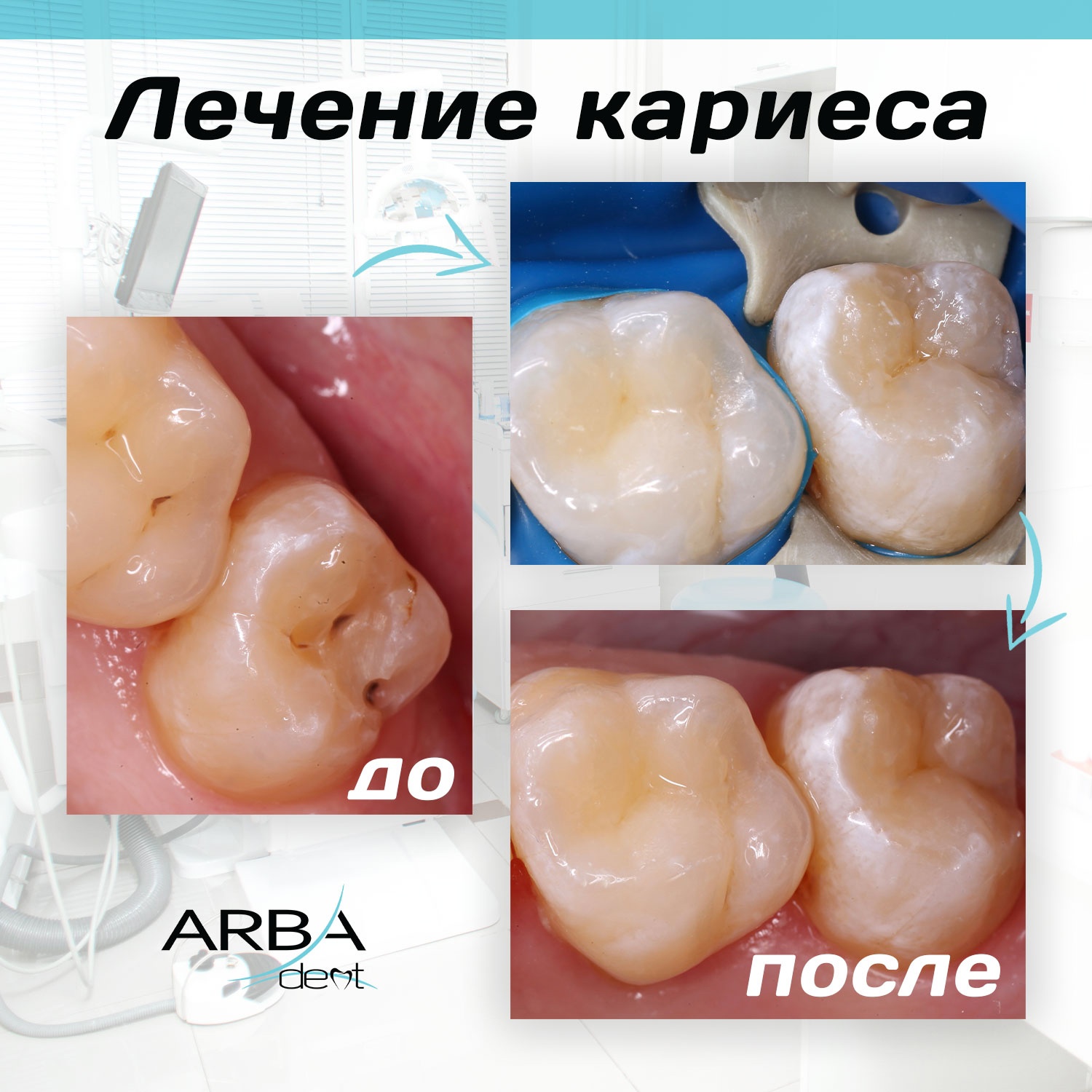 Результат лечения