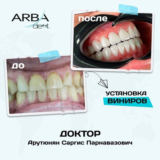 Результат лечения — до и после