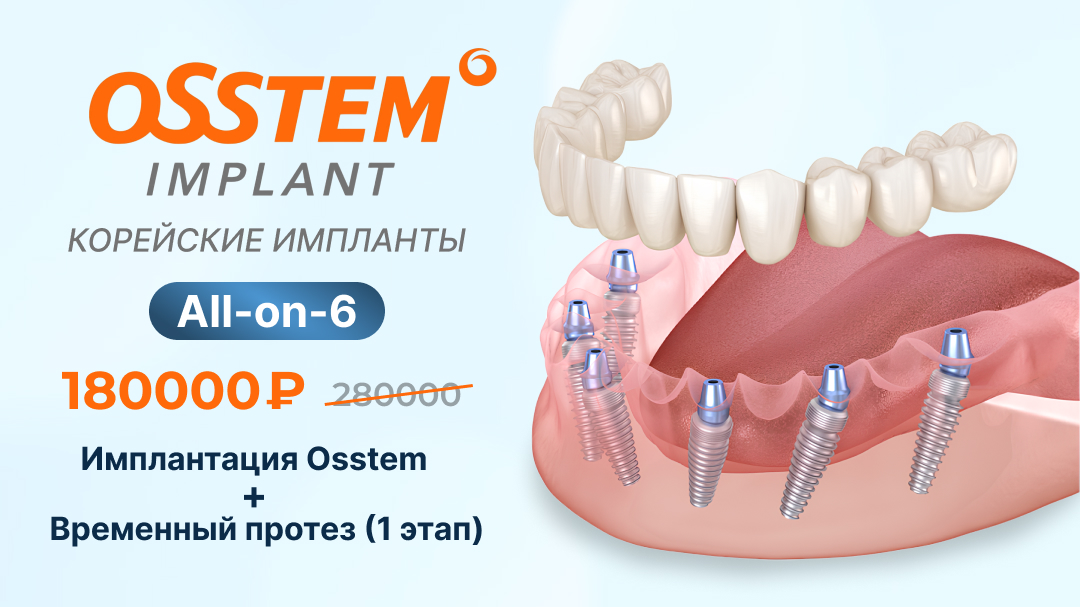 All-on-6 от Osstem