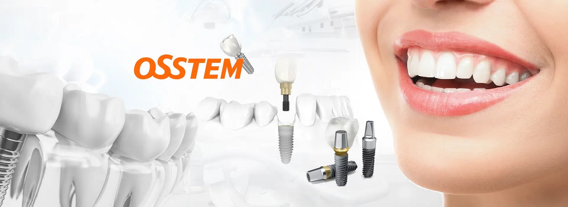Импланты Osstem – надежные корейские зубные импланты