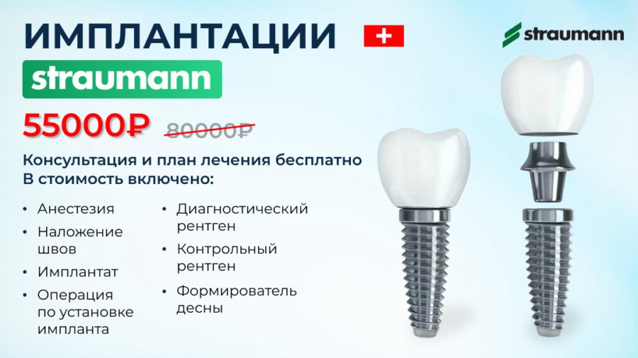 Импланты Straumann – Премиум-решение для восстановления зубов
